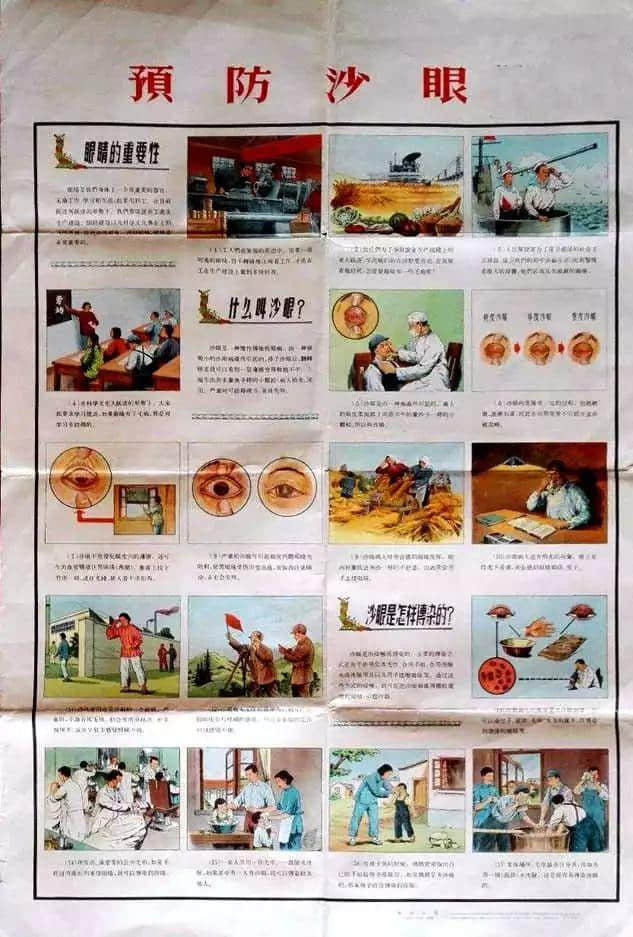 惊悚:六十年前我们怎样治砂眼? 惊悚:六十年前我们怎样治砂眼?