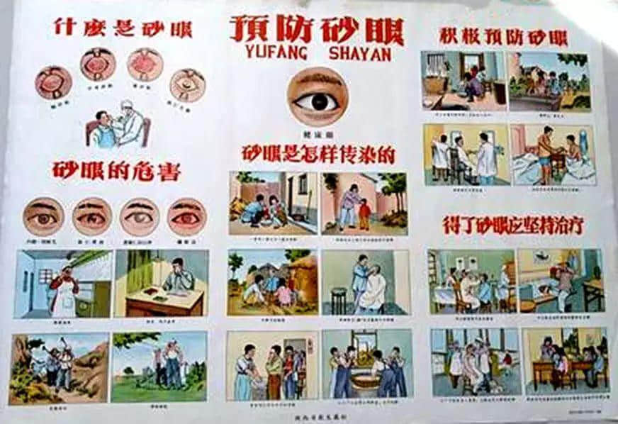 惊悚:六十年前我们怎样治砂眼? 惊悚:六十年前我们怎样治砂眼?