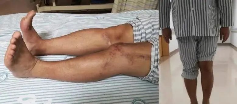 广州将实行最严“电鸡”新规,骑手成“弱势群体”? 广州将实行最严“电鸡”新规,骑手成“弱势群体”?