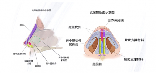 结构决定形态：揭秘中家医金字塔三角支架鼻综合的7大技术体系